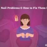 Common Nail Problems & How to Fix Them Like a Pro